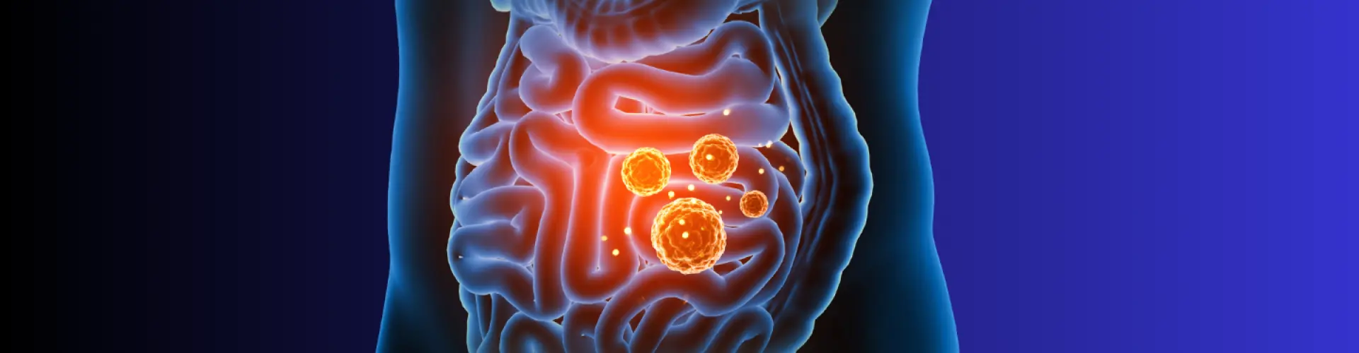 Heal Your Gut Lining  - Online Class by Holly Blazina